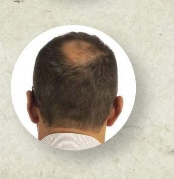 E661 CC GORDON Zhušťující vlákna pro světlé blond vlasy 22 GR E661 CC GORDON Zhušťující vlákna pro světlé blond vlasy 22 GR